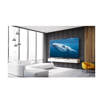 65UP7500 LED ULTRA HD TV LG